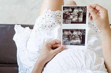 How to Start a 3d 4d Ultrasound Business