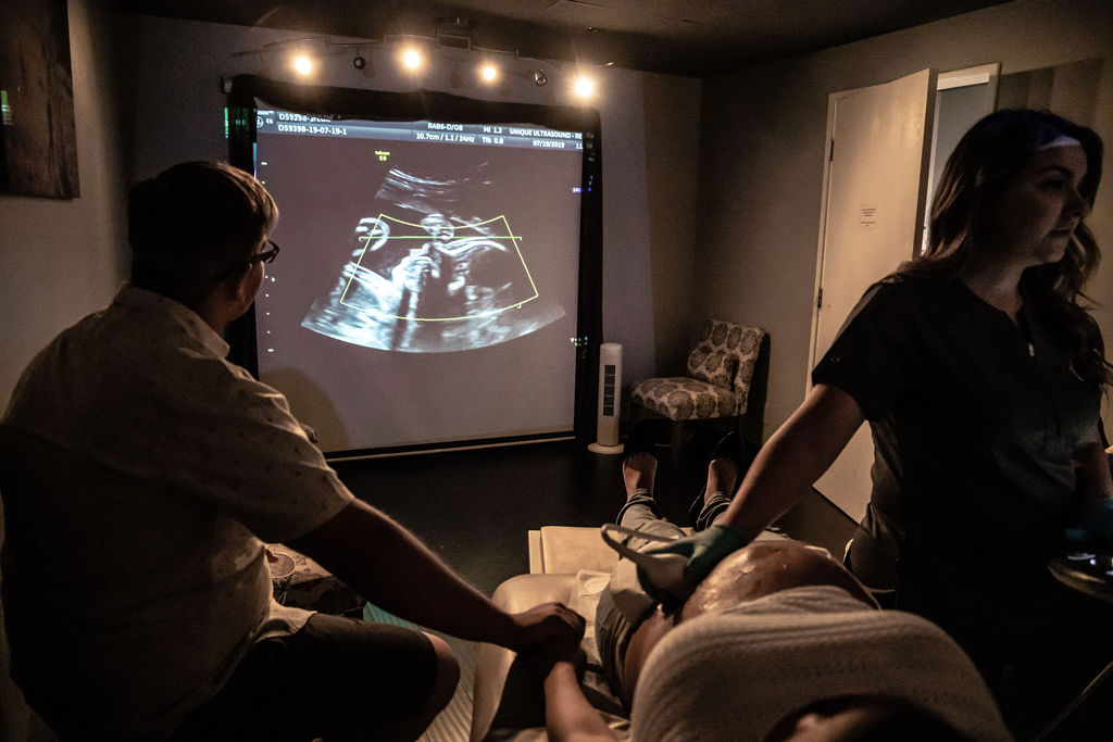 Unique Ultrasound Redlands screening room